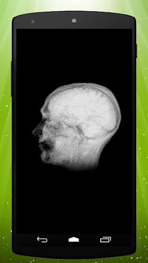 Brain Scan Live Wallpaper