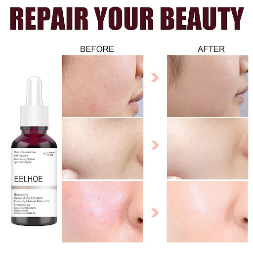 Title 5, Salicylic Acid Moisturizing Serum Gentle Care S...