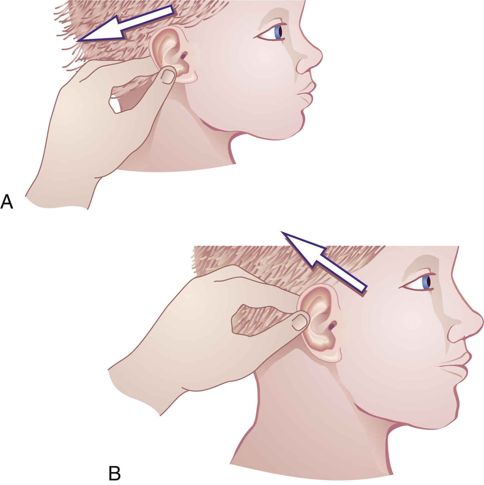 Tư thế nhỏ thuốc đúng