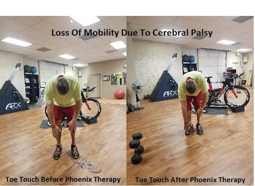 Sports Therapy Doctor Gilbert AZ 