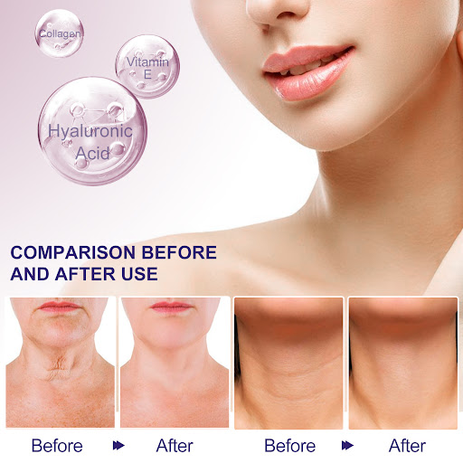 Title 6, Neck Skin Firming Deep Hydrating Cream Reduces ...