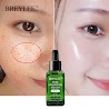 Breylee Serum Se Khít Lỗ Chân Lông Da Săn Chắc Mịn Màng Dưỡng Ẩm 17Ml