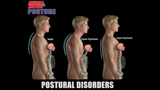 How to mod Muscle and Motion POSTURE lastet apk for android