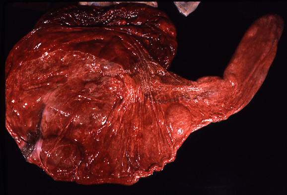 Chorionic surface of the placenta from a singleton foal born subsequent to a fetal twin reduction at Day 115 of gestation. Note that part of the uterine body and horn have a very sparse formation of microvilli.