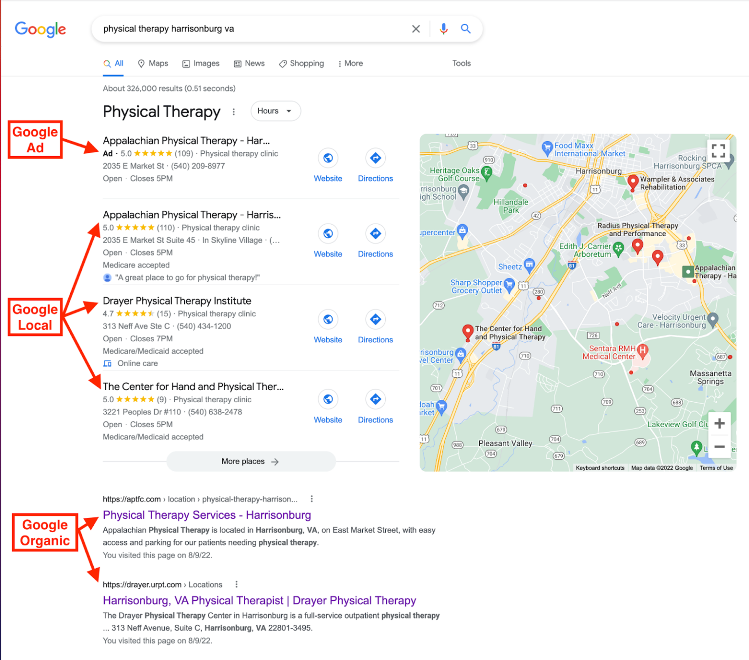 physical therapy google results