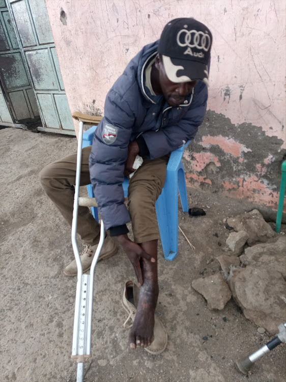 John Kamau from Kasarani estate in North Lake show injuries inflicted by a hippo in Lake Naivasha while he was fishing.