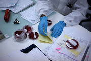 Listeria monocytogenes cultures are seen in a lab at The National Institute for Communicable Diseases in Johannesburg. The institute is currntly dealing with Listeria The institute is dealing with the listeriosis outbreak in South Africa.