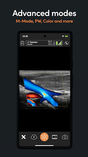 Screenshot Clarius Ultrasound