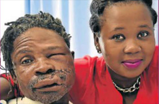 Zwelake Dyan is recovering well in hospital. With him is his daughter, Bulelwa, 26. Picture: Eugene Coetzee