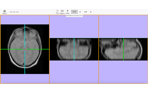 Med3D DICOM