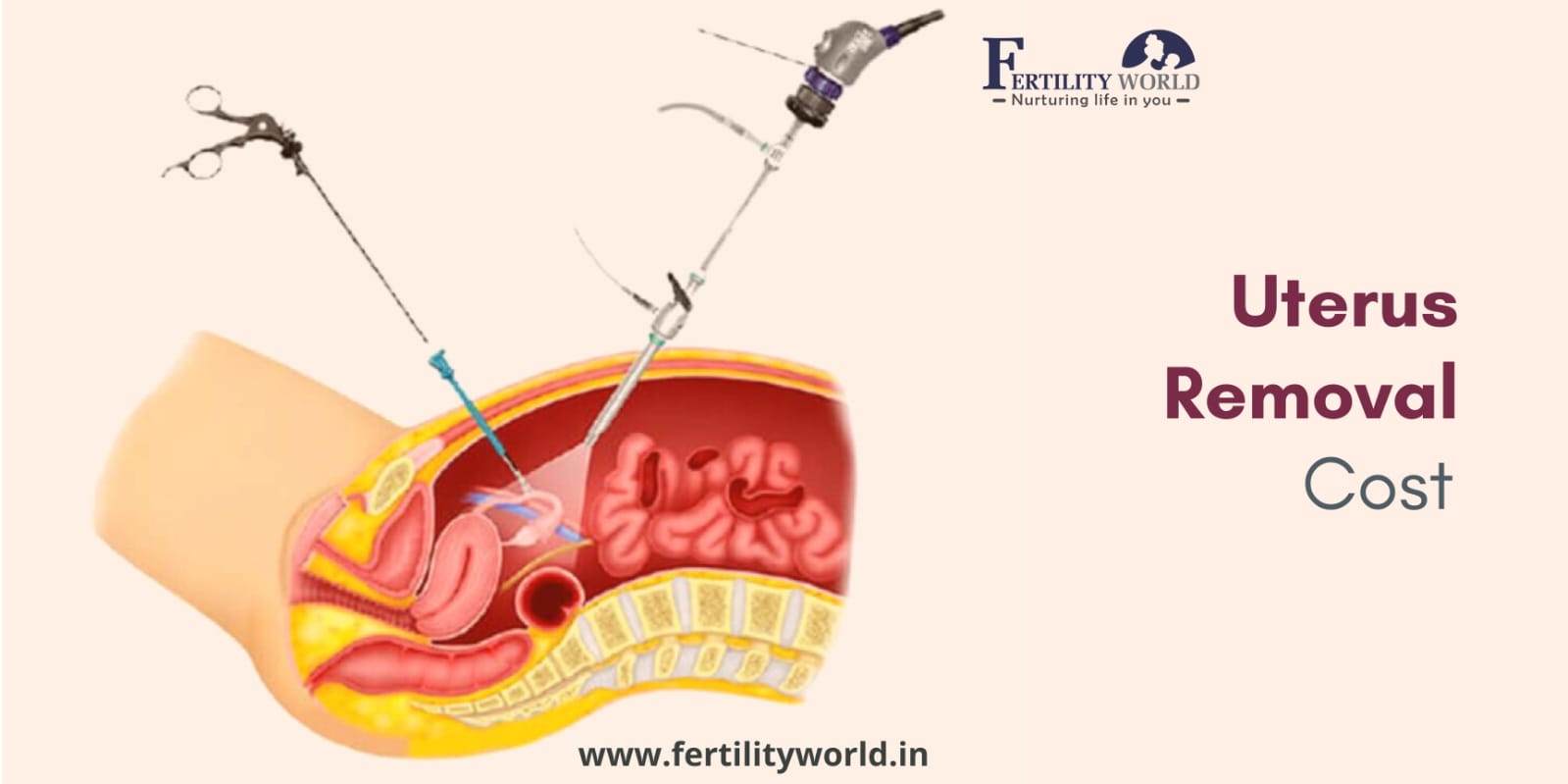 More details of laparoscopy surgery for uterus removal cost