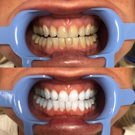 Elite Smile Dental Clinic, Baner — business photo 5