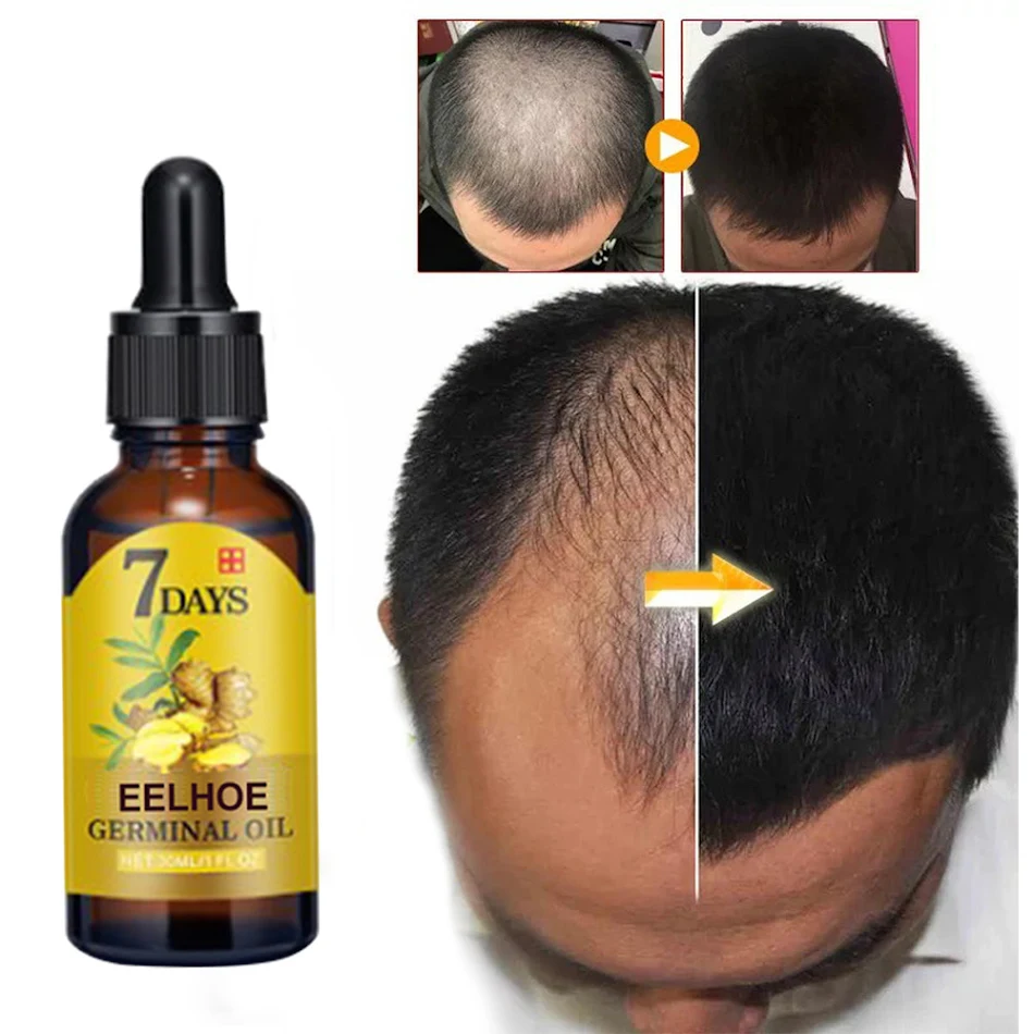 Ingwer Haarpflege Feuchtigkeitsspendende Anti-Haarausfall Nährstofflösung für gesünderes Haarwachstum und zur Stärkung.