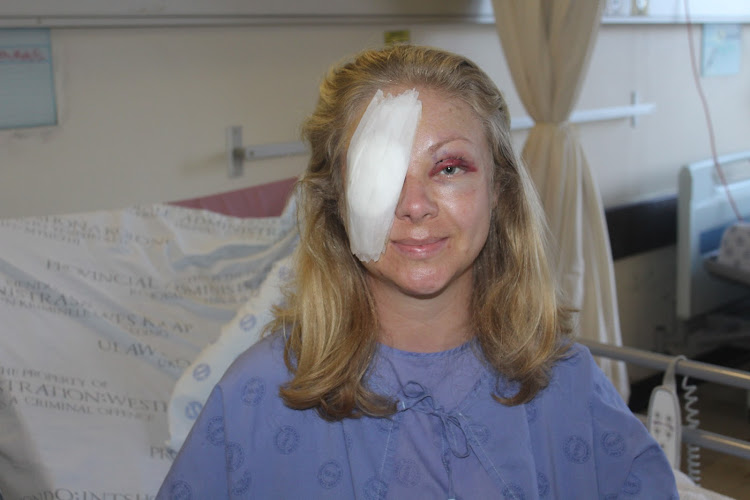 Ingrid Barge became the first patient to have a sophisticated eye surgery, corneal neurotisation in South Africa. The procedure will bring back sensibility and improved vision to her eye.