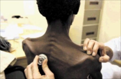 HUNGRY: A doctor examines an HIV-Aids patient at a clinic. Pic: JAMES OATWAY. 123/08/2009. © Sunday Times.