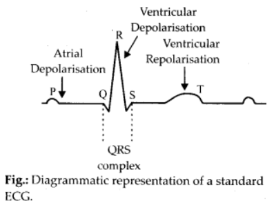 Solution Image