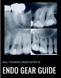 Gear Guide to make endo fun again!!