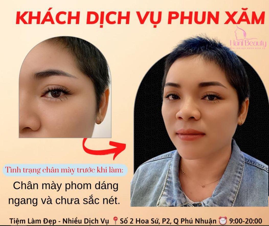 https://lh3.googleusercontent.com/Y4lxKK2gWItog-iT_G1Nak3LdJcE5NVOegsfXnOILgEQKP5f1aX-cbZDkm5GbGDrK9-VVplwuYaM-q6irJSU9G_6_holKXP0hYW_R1DiTASE5uyZStbNbH0zAuLNrORfh3sPHB4DE6GWP3M0WSWhYw