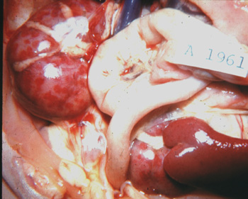 Pathological changes in the kidneys: petechial or ecchymotic hemorrhages and focal necrosis, giving the kidneys a "speckled" appearance - circumscribed areas of hemorrhage ("red spots") on a pale gray cortex.