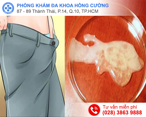 Đoán bệnh nam khoa qua màu sắc tinh dịch bất thường YDmw4JfwwgMlFWTkPXy03hdI6q2a3PhsUVfrL27TFmYRIQP87F8TQdGTH7W1vRgHnz62a9QYQa8tiMpgT-yNeta8W-Ul7L20TnWDJW1ZR-J1s6nv9stmTuy7kseP0_EZHD3LQafyTD6hVtyUl0wcQQ