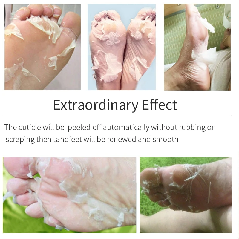 Title 5, Aloe Vera Voetmasker Peeling voor Voeten, Exfol...