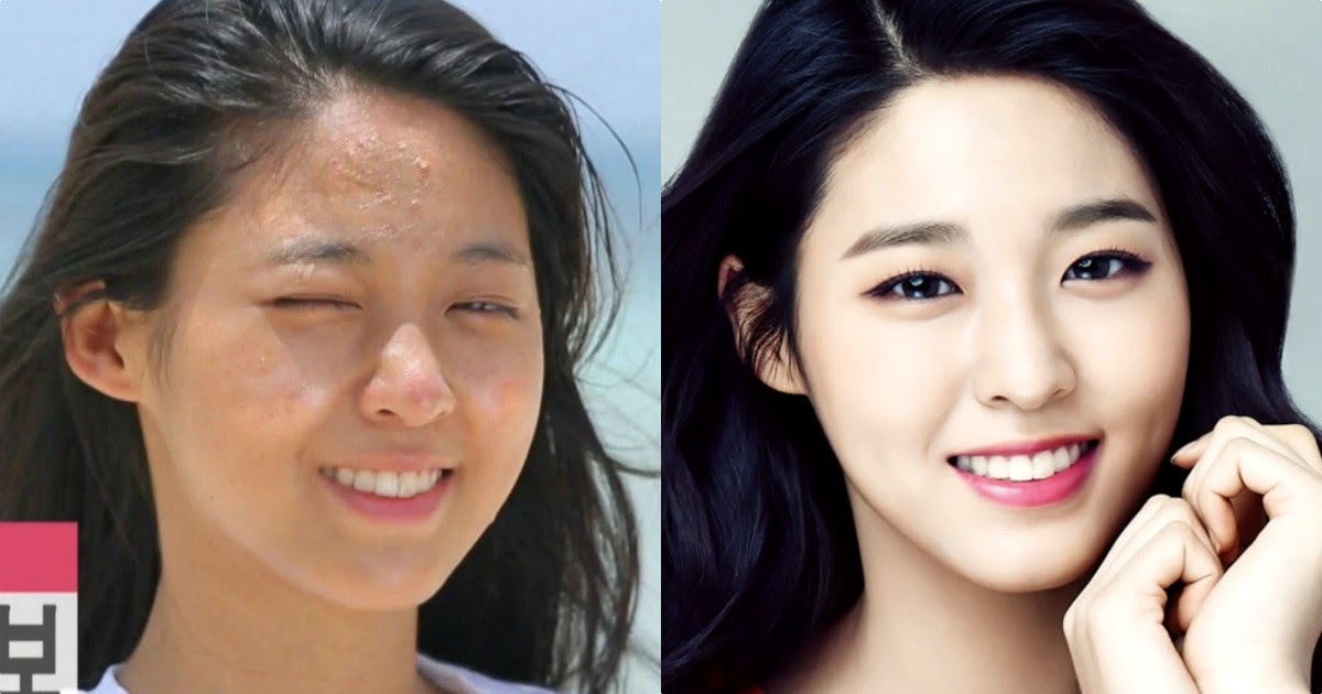 20 Idols Whose Skin Was Tragically Damaged By Makeup.