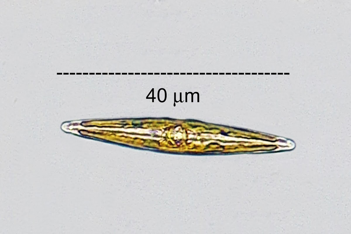 Epilithic Diatom