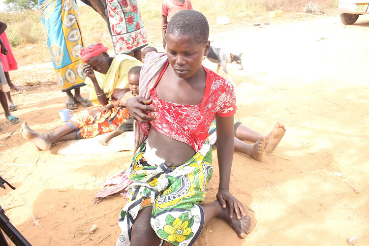 Bendera Karisa shows the injury on her stomach after she was attacked by a leopard on March 2 in Jila village, Ganze.