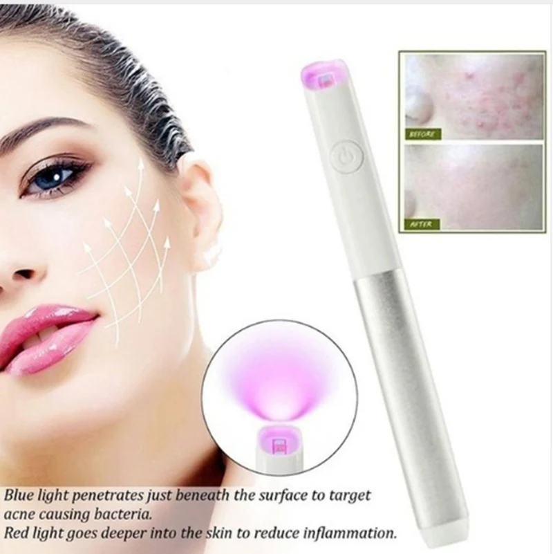 Acne Pen with Red and Blue LED Light for Acne Mark Rehabilitation. Facial Beauty Instrument to Reduce Acne and Improve S