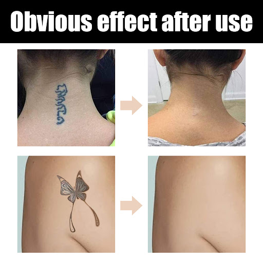 Title 4, Waterproof Brightening Cover for Tattoos, Scars...