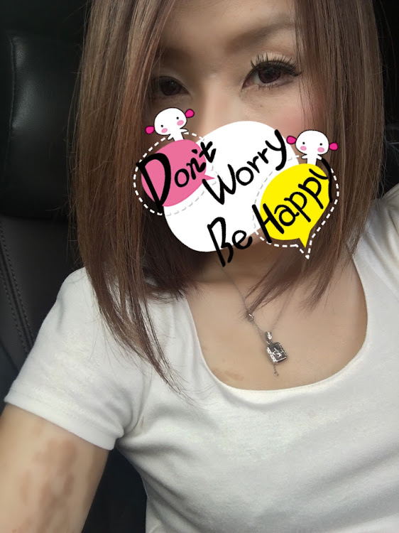 タントエグゼカスタムのバッテリーマイナス・エンストの件・ホントごめんなさい・入院せずに済みましたに関するカスタム事例の投稿画像2枚目