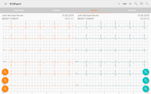 ECG Expert(圖3)-速報App