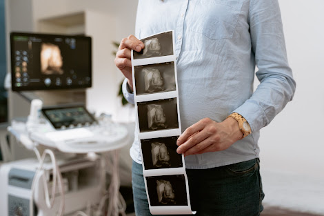 Kobieta w ciąży pokazująca USG