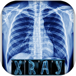 Chest X-ray interpretation Apk