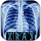 Download Chest X-ray interpretation For PC Windows and Mac 1.0