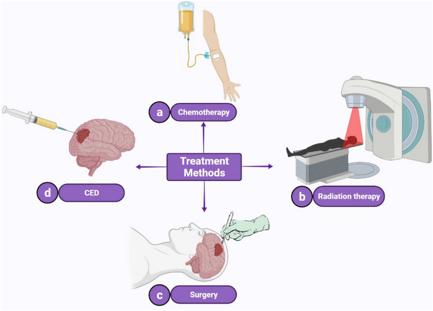 brain tumor treatment in India