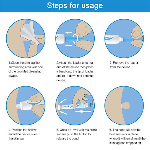 Title 2, Auto Skin Tag Remover Painless Facial Beauty To...