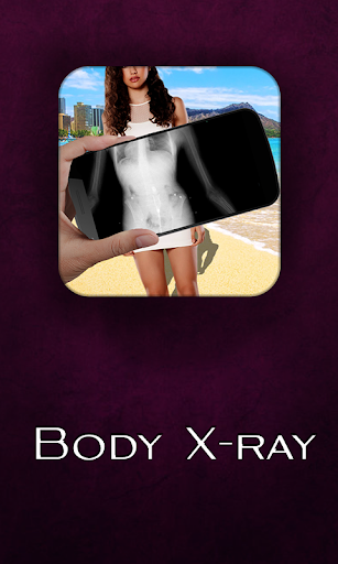 X Ray Camera - Human Body