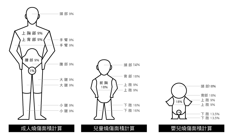 燒傷面積計算說明