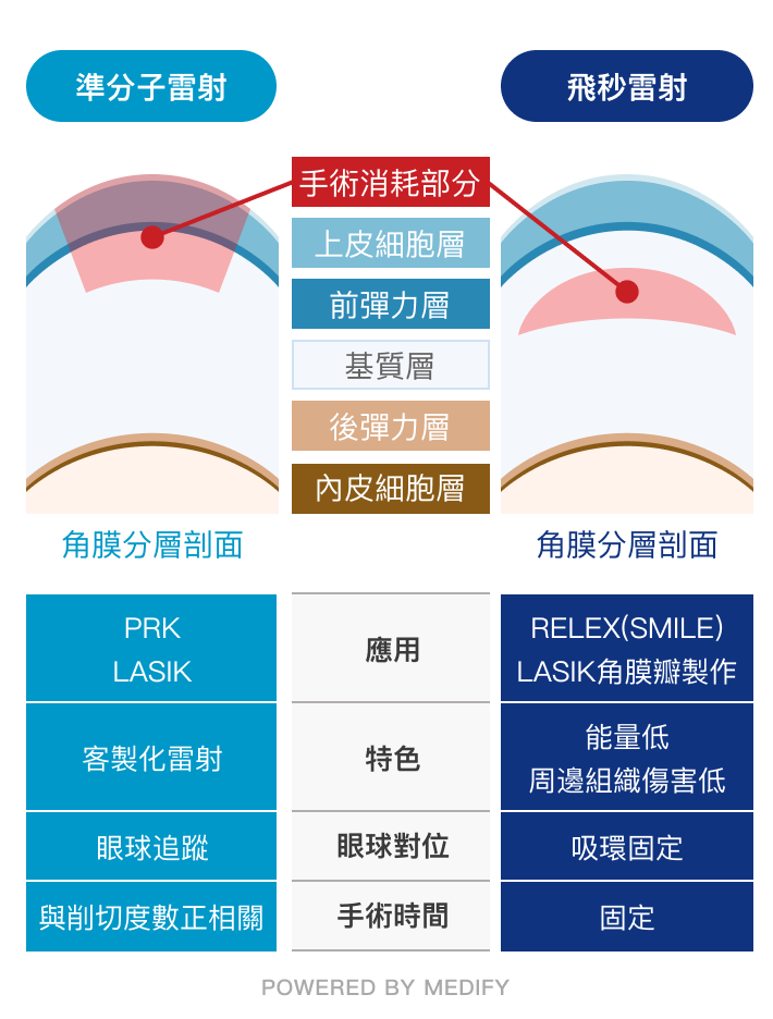 近視雷射中分準分子雷射和飛秒雷射，與其手術消耗部位