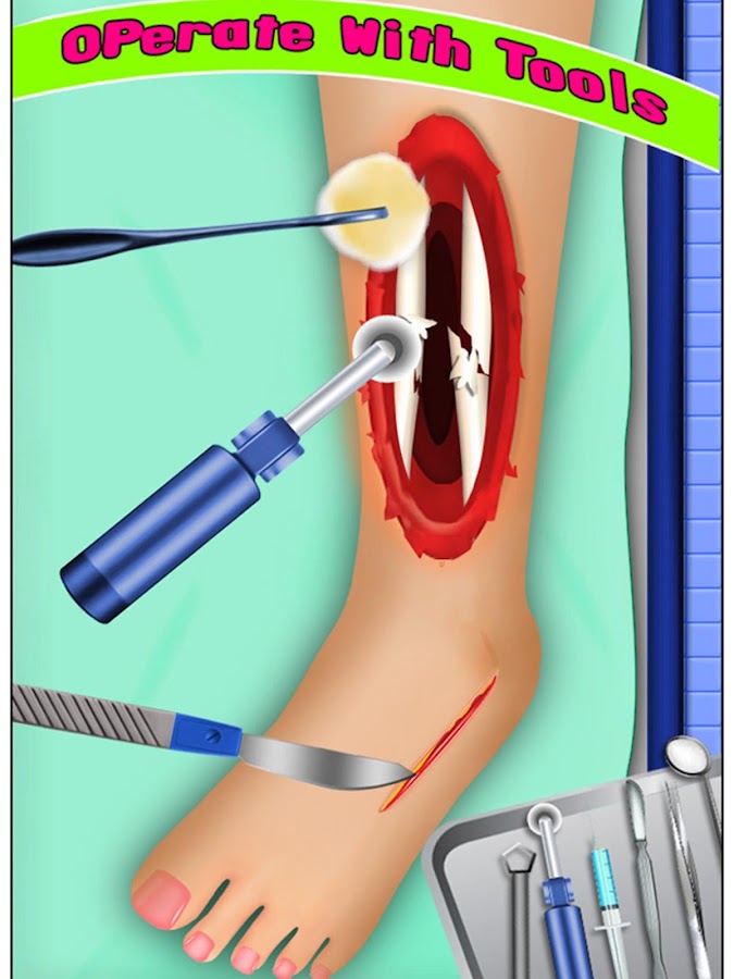 Virtual Leg Surgery 72