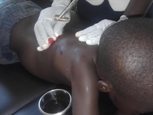 Six year old Jeremy Otieno Adongo who was shot at the back in their house at Kasule, Manyatta Estate in Kisumu/MAURICE ALAL