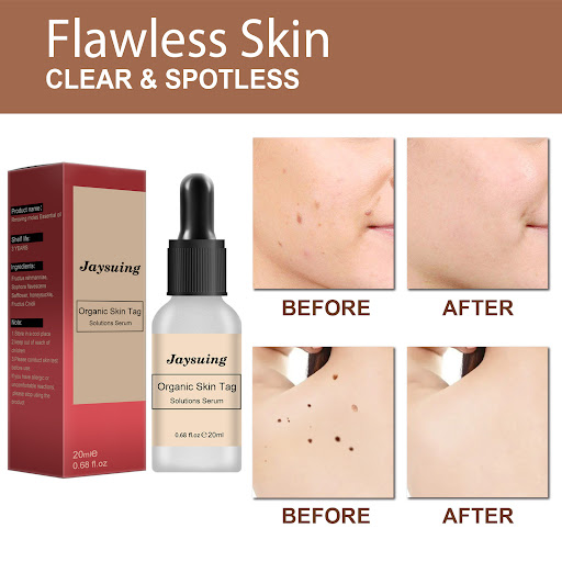 Title 4, Anti-Mole Potion Repair Smooth Skin Wart Care. ...