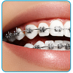 Cover Image of Download Braces Photo Editor - Braces Filter Colored 4.5 APK