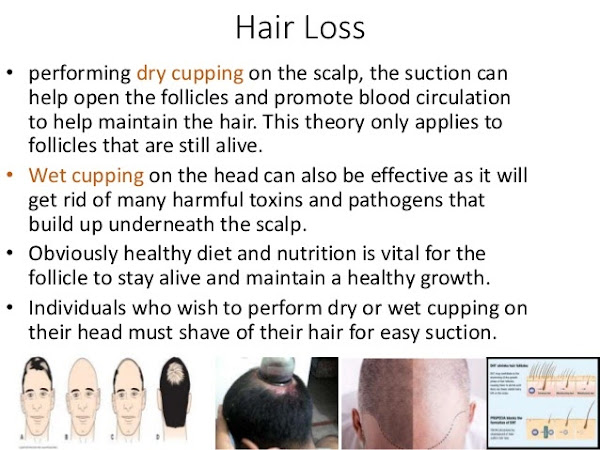 Hijama Centre