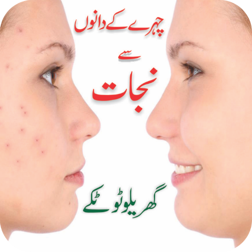 Face Pimples Home Remedy Solutions  -  Urdu Tips
