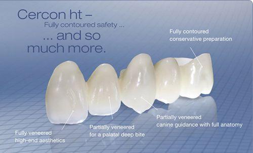 C:\Users\Phuong Tran\Desktop\7.10 răng sứ zirconia và cercon\Rang-su-zirconia-va-cercon-1.jpg