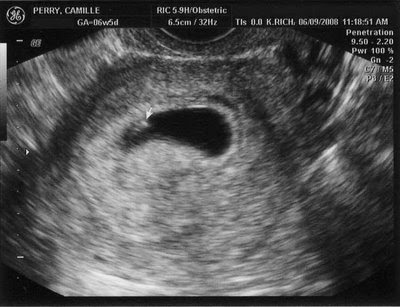 My Baby Bump It S Really There