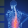 Back Pain & How To Prevent It icon