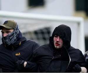 Beerschot-fan die veld betrad wel héél hardhandig aangepakt door politie: schedelbreuk en verbrijzelde oogkas 